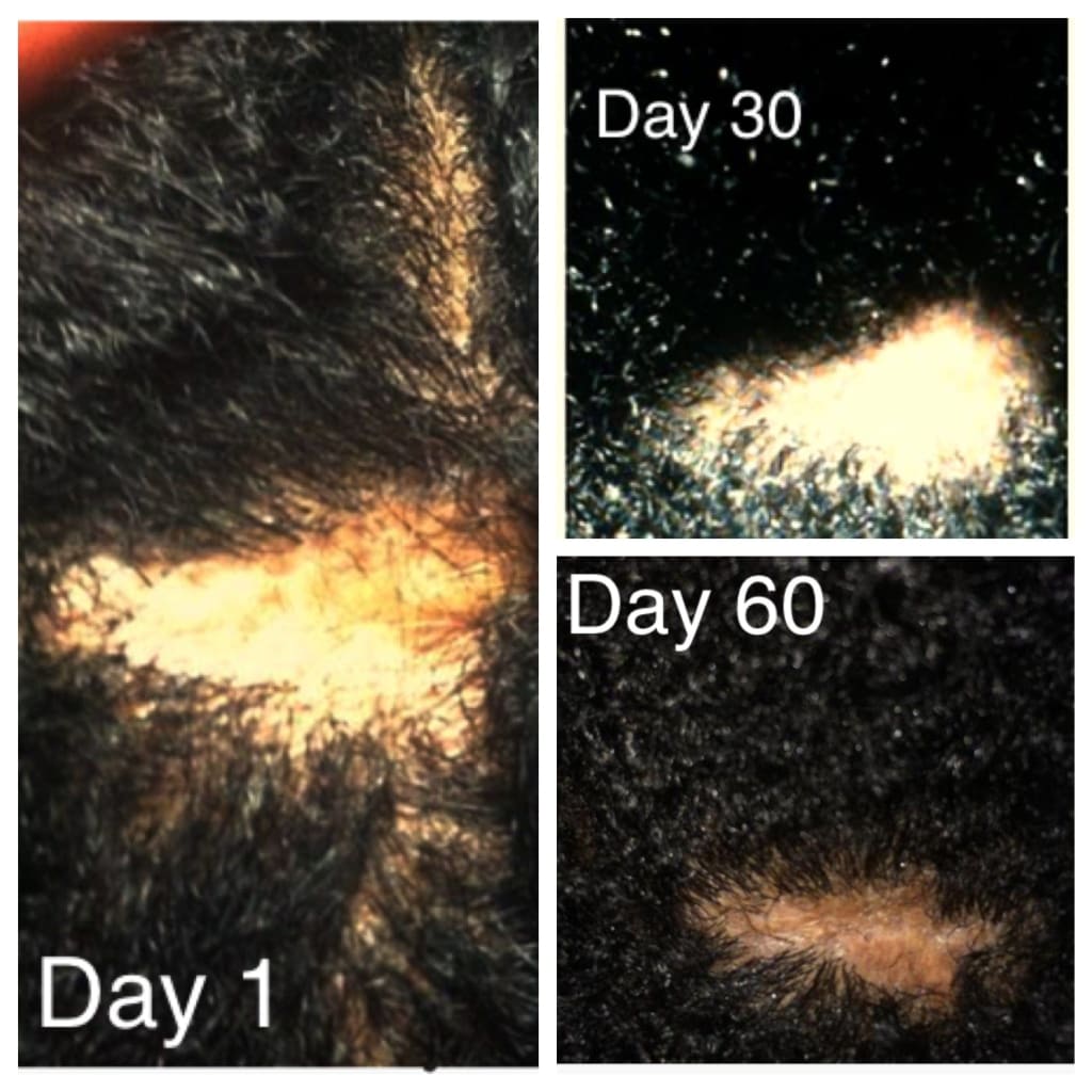 Goddess growth potion-hair loss treatment - Hair Loss