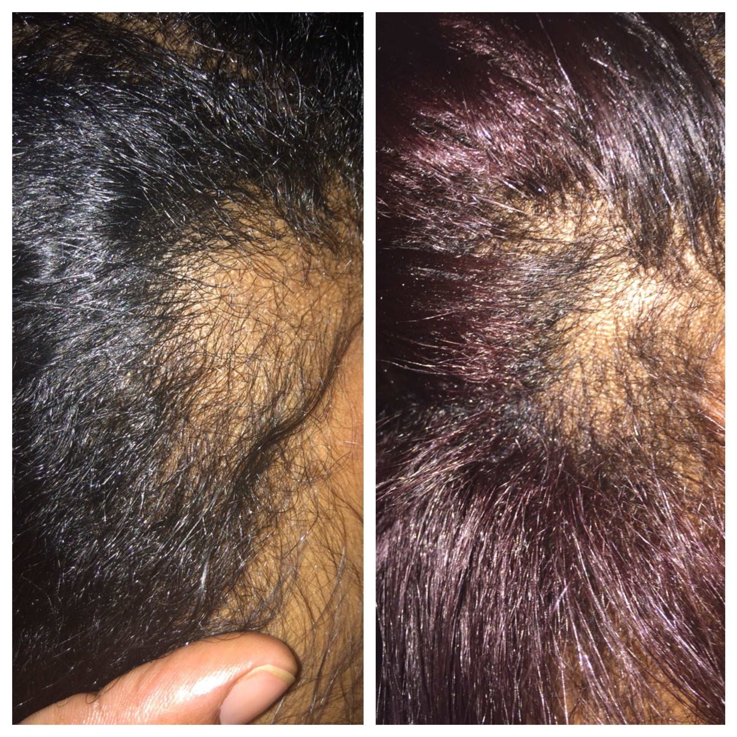 Growth Potion-Hair Loss Treatment-Hair Loss Treatments-DopeAlchemy-2 oz-DopeAlchemy.com